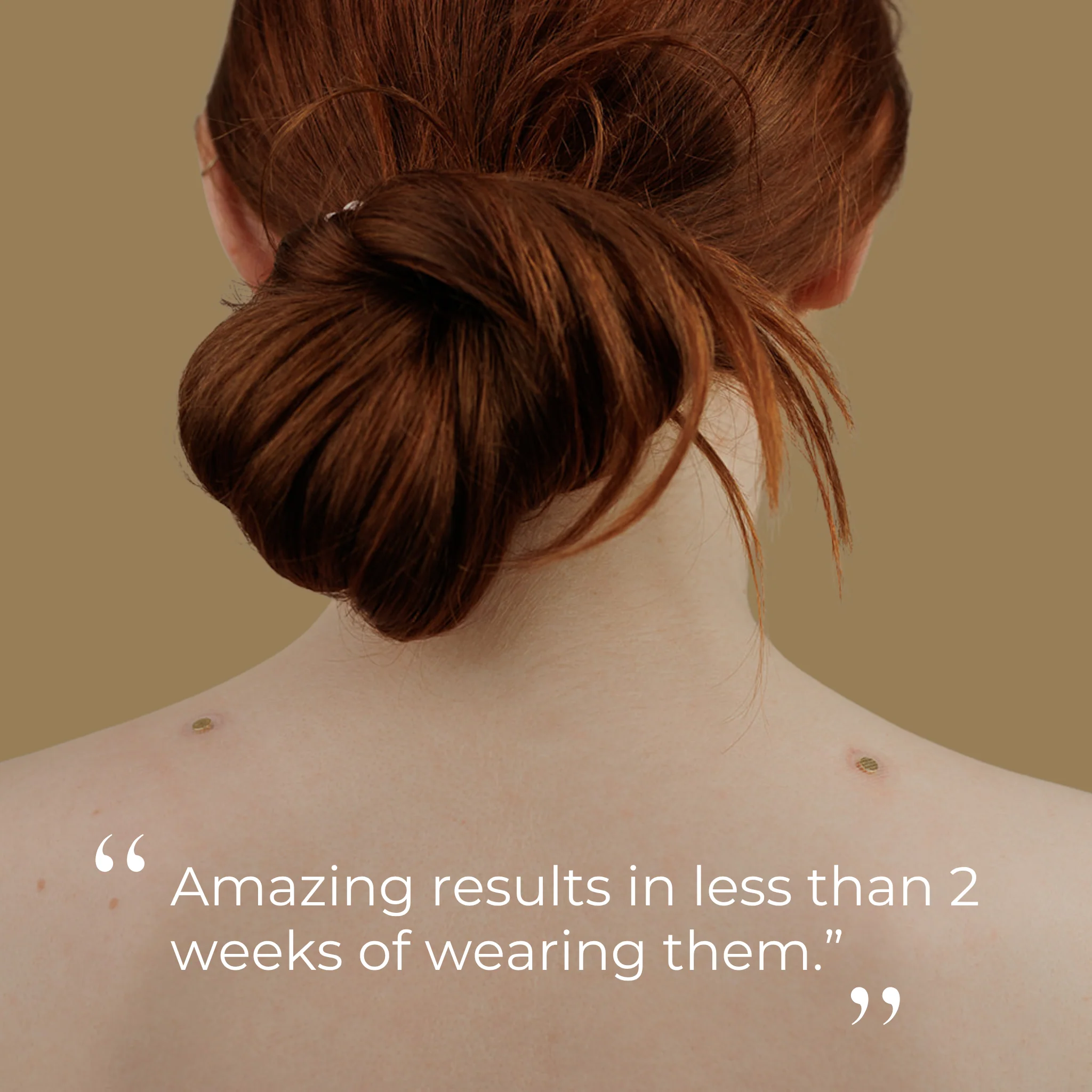 Gold Acupressure Magnet Patches - Image 7